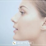 عملية تجميل الأنف في تركيا.