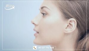 عملية تجميل الأنف في تركيا.